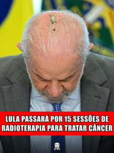 LULA PASSARÁ POR 15 SESSÕES DE RADIOTERAPIA PARA TRATAR CÂNCER