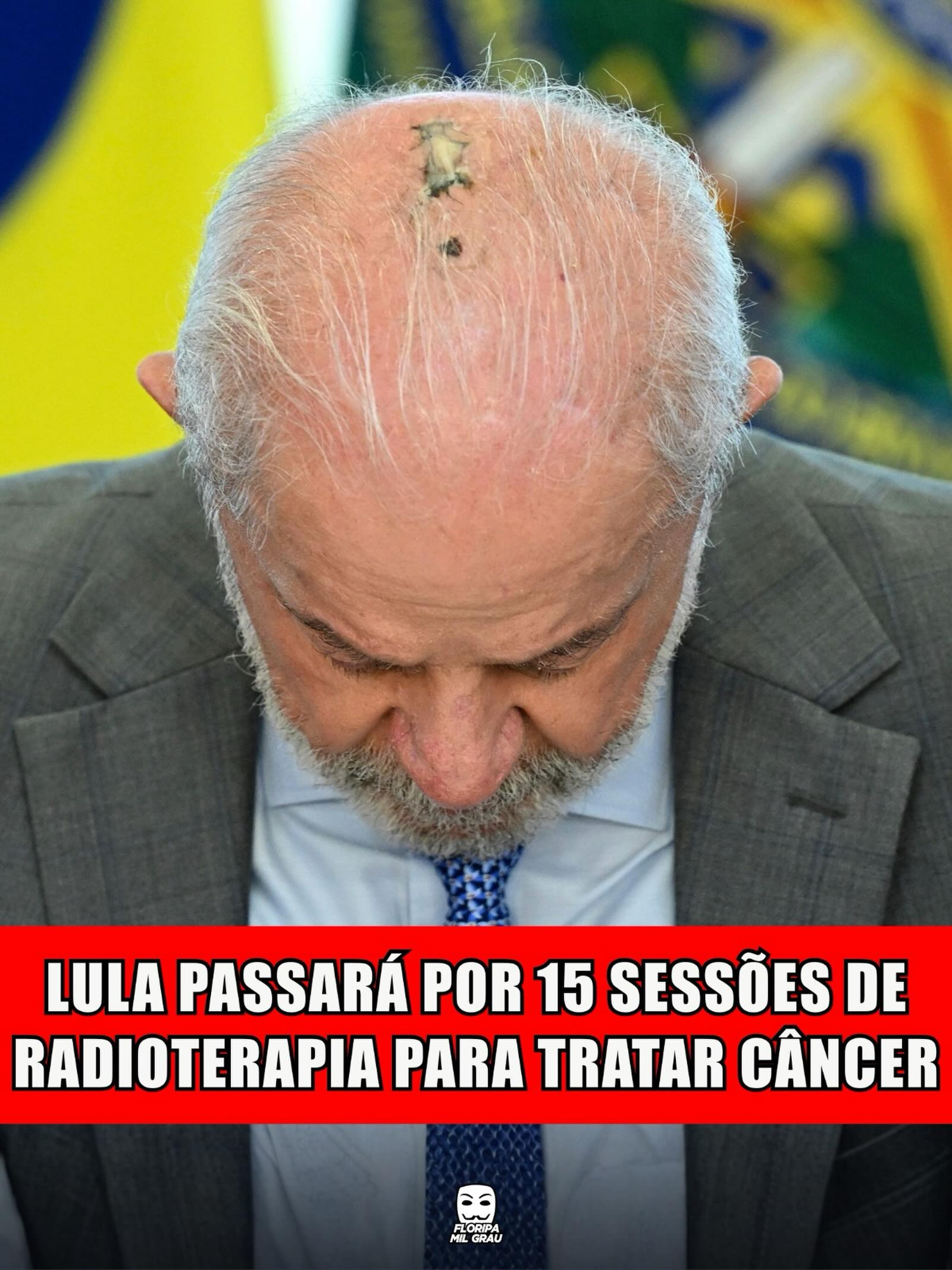 LULA PASSARÁ POR 15 SESSÕES DE RADIOTERAPIA PARA TRATAR CÂNCER