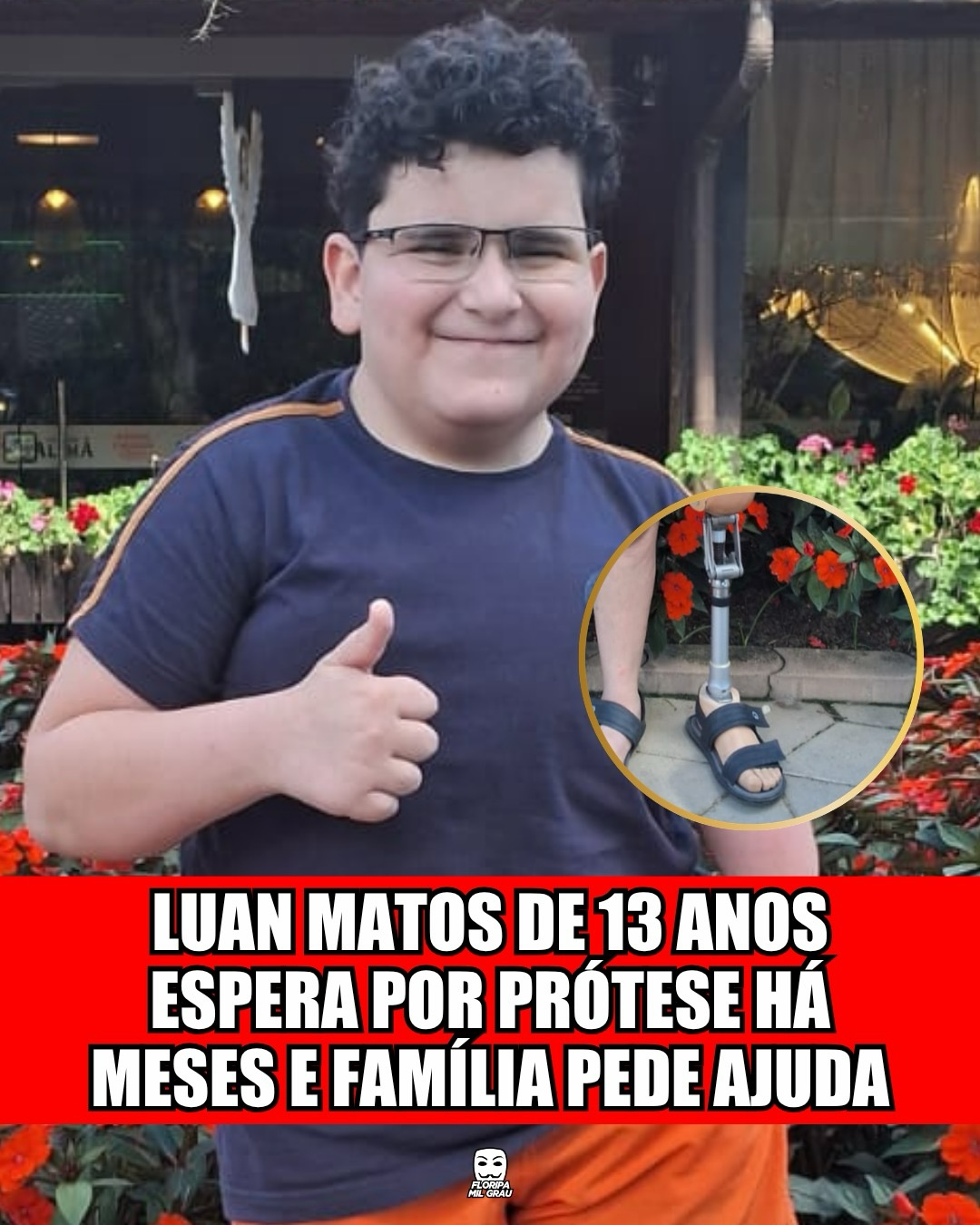 LUAN MATOS DE 13 ANOS ESPERA POR PRÓTESE HÁ MESES E FAMÍLIA PEDE AJUDA
