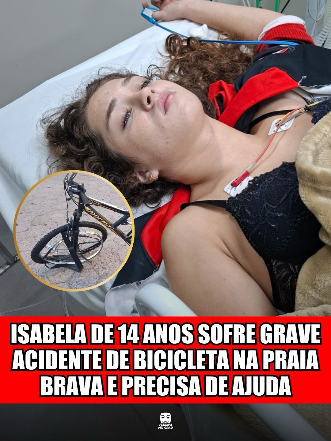 Menina de 14 anos fratura três vértebras em acidente de bicicleta na Praia Brava