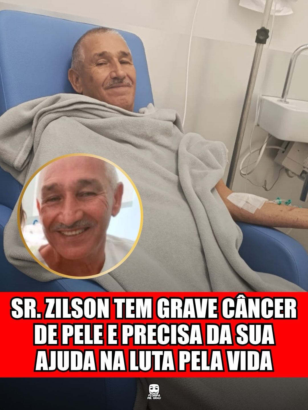 SR. ZILSON TEM GRAVE CÂNCER DE PELE E PRECISA DA SUA AJUDA NA LUTA PELA VIDA