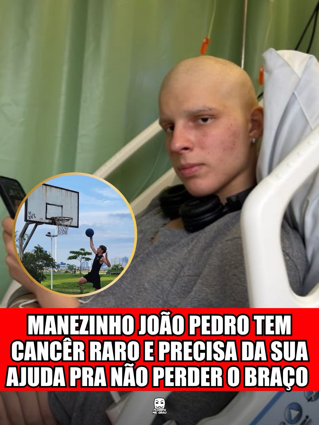 MANEZINHO JOÃO PEDRO TEM CÂNCER RARO E PRECISA DA SUA AJUDA PRA NÃO PERDER O BRAÇO