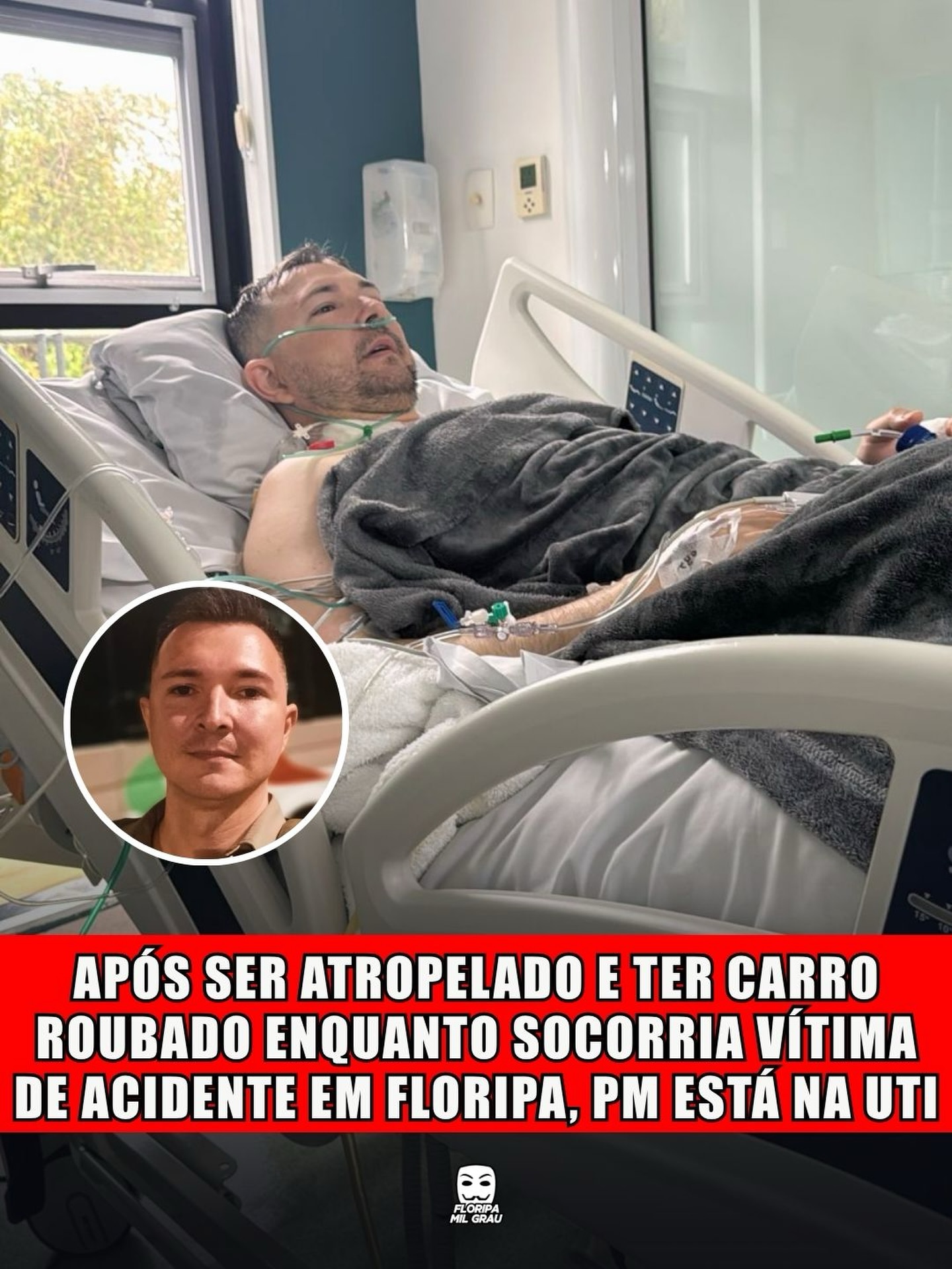 APÓS SER ATROPELADO E TER CARRO ROUBADO ENQUANTO SOCORRIA VÍTIMA DE ACIDENTE EM FLORIPA, PM ESTÁ NA UTI