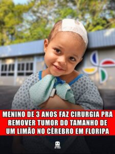 MENINO DE 3 ANOS FAZ CIRURGIA PRA REMOVER TUMOR DO TAMANHO DE UM LIMÃO NO CÉREBRO EM FLORIPA